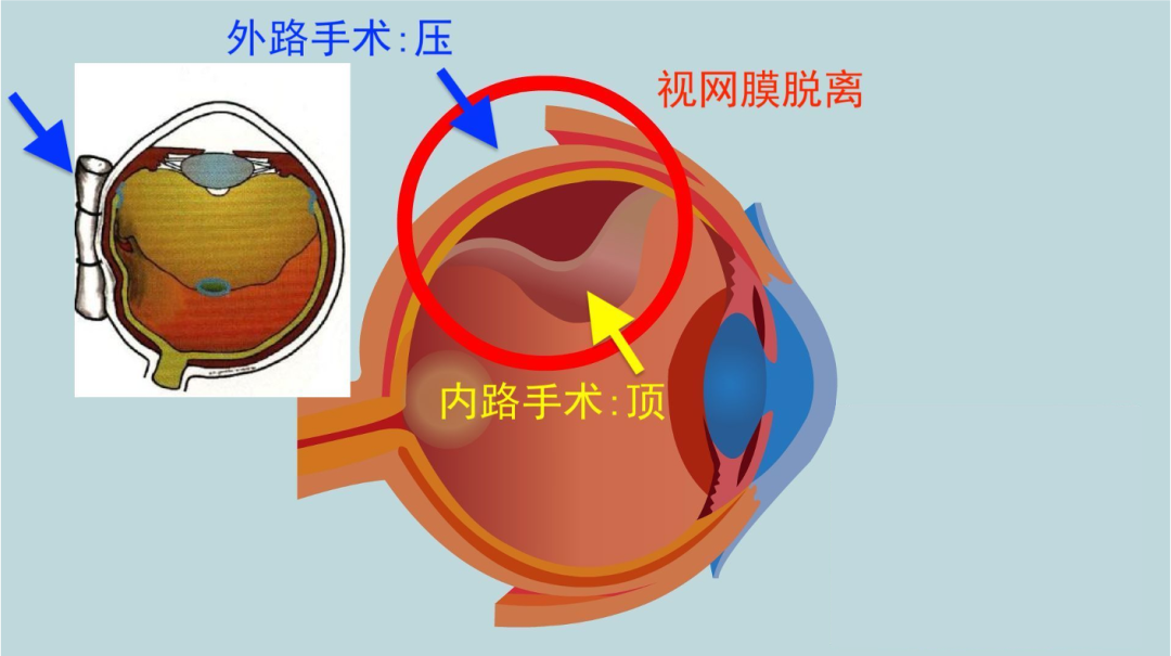 图片 3.png